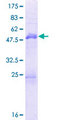 MBNL3 Protein - 12.5% SDS-PAGE of human MBNL3 stained with Coomassie Blue