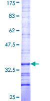 MBNL3 Protein - 12.5% SDS-PAGE Stained with Coomassie Blue.