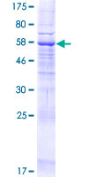 MBOAT2 Protein - 12.5% SDS-PAGE of human MBOAT2 stained with Coomassie Blue