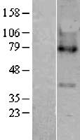 MBOAT5 / C3F Protein - Western validation with an anti-DDK antibody * L: Control HEK293 lysate R: Over-expression lysate