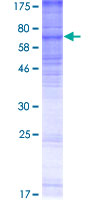 MBOAT5 / C3F Protein - 12.5% SDS-PAGE of human MBOAT5 stained with Coomassie Blue