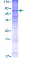 MBOAT5 / C3F Protein - 12.5% SDS-PAGE of human MBOAT5 stained with Coomassie Blue