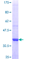 MBOAT7 / BB1 Protein - 12.5% SDS-PAGE Stained with Coomassie Blue.