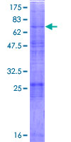 MBTPS2 Protein - 12.5% SDS-PAGE of human MBTPS2 stained with Coomassie Blue