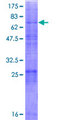 MBTPS2 Protein - 12.5% SDS-PAGE of human MBTPS2 stained with Coomassie Blue
