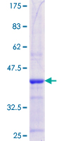 MBTPS2 Protein - 12.5% SDS-PAGE Stained with Coomassie Blue.