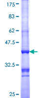 MC1R Protein - 12.5% SDS-PAGE Stained with Coomassie Blue.