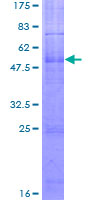 MC2R / ACTHR / ACTH Receptor Protein - 12.5% SDS-PAGE of human MC2R stained with Coomassie Blue