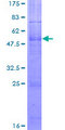 MC2R / ACTHR / ACTH Receptor Protein - 12.5% SDS-PAGE of human MC2R stained with Coomassie Blue