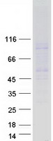 MC2R / ACTHR / ACTH Receptor Protein - Purified recombinant protein MC2R was analyzed by SDS-PAGE gel and Coomassie Blue Staining