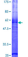MC3R / MC3 Receptor Protein - 12.5% SDS-PAGE of human MC3R stained with Coomassie Blue