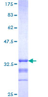 MC3R / MC3 Receptor Protein - 12.5% SDS-PAGE Stained with Coomassie Blue.