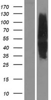 MC4R / Melanocortin 4 Receptor Protein - Western validation with an anti-DDK antibody * L: Control HEK293 lysate R: Over-expression lysate