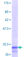 MC4R / Melanocortin 4 Receptor Protein - 12.5% SDS-PAGE Stained with Coomassie Blue.
