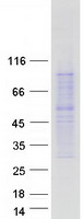 MC4R / Melanocortin 4 Receptor Protein - Purified recombinant protein MC4R was analyzed by SDS-PAGE gel and Coomassie Blue Staining