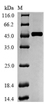 MCAD / ACADM Protein - (Tris-Glycine gel) Discontinuous SDS-PAGE (reduced) with 5% enrichment gel and 15% separation gel.
