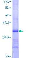 MCAD / ACADM Protein - 12.5% SDS-PAGE Stained with Coomassie Blue.