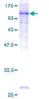 MCAM / CD146 Protein - 12.5% SDS-PAGE of human MCAM stained with Coomassie Blue