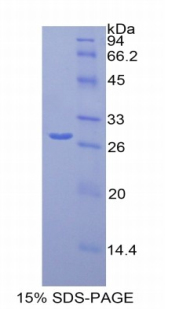 MCAM / CD146 Protein - Recombinant Melanoma Cell Adhesion Molecule By SDS-PAGE