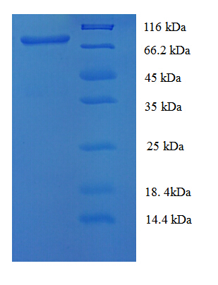 MCAM / CD146 Protein