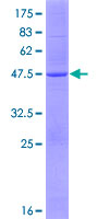 MCAT Protein - 12.5% SDS-PAGE of human MCAT stained with Coomassie Blue