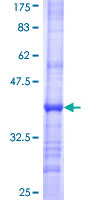 MCAT Protein - 12.5% SDS-PAGE Stained with Coomassie Blue