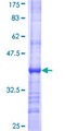 MCAT Protein - 12.5% SDS-PAGE Stained with Coomassie Blue