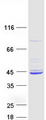 MCAT Protein - Purified recombinant protein MCAT was analyzed by SDS-PAGE gel and Coomassie Blue Staining