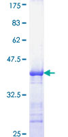 MCC Protein - 12.5% SDS-PAGE Stained with Coomassie Blue.