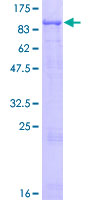 MCCC1 Protein - 12.5% SDS-PAGE of human MCCC1 stained with Coomassie Blue