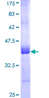 MCCC1 Protein - 12.5% SDS-PAGE Stained with Coomassie Blue.
