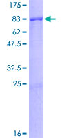 MCCC2 / MCCB Protein - 12.5% SDS-PAGE of human MCCC2 stained with Coomassie Blue