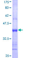 MCCC2 / MCCB Protein - 12.5% SDS-PAGE Stained with Coomassie Blue.