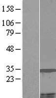 MCCD1 Protein - Western validation with an anti-DDK antibody * L: Control HEK293 lysate R: Over-expression lysate
