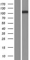 MCF2 / DBL Protein - Western validation with an anti-DDK antibody * L: Control HEK293 lysate R: Over-expression lysate