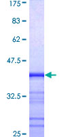 MCF2L / DBS Protein - 12.5% SDS-PAGE Stained with Coomassie Blue.