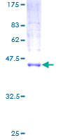 MCFD2 Protein - 12.5% SDS-PAGE of human MCFD2 stained with Coomassie Blue
