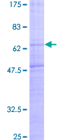 MCHR1 Protein - 12.5% SDS-PAGE of human GPR24 stained with Coomassie Blue