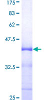 MCHR1 Protein - 12.5% SDS-PAGE Stained with Coomassie Blue.