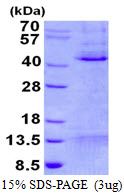 MCL1 / MCL 1 Protein