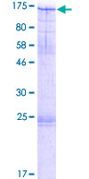 MCM10 Protein - 12.5% SDS-PAGE of human MCM10 stained with Coomassie Blue