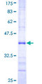 MCM2 Protein - 12.5% SDS-PAGE Stained with Coomassie Blue.