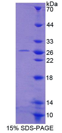 MCM3 Protein - Recombinant Minichromosome Maintenance Deficient 3 (MCM3) by SDS-PAGE