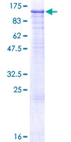 MCM4 Protein - 12.5% SDS-PAGE of human MCM4 stained with Coomassie Blue