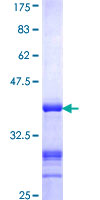 MCM4 Protein - 12.5% SDS-PAGE Stained with Coomassie Blue.