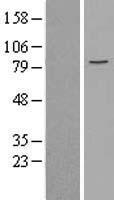 MCM5 Protein - Western validation with an anti-DDK antibody * L: Control HEK293 lysate R: Over-expression lysate