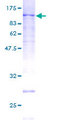 MCM5 Protein - 12.5% SDS-PAGE of human MCM5 stained with Coomassie Blue