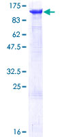 MCM6 Protein - 12.5% SDS-PAGE of human MCM6 stained with Coomassie Blue