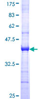 MCM6 Protein - 12.5% SDS-PAGE Stained with Coomassie Blue.