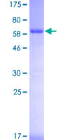 MCM7 Protein - 12.5% SDS-PAGE of human MCM7 stained with Coomassie Blue